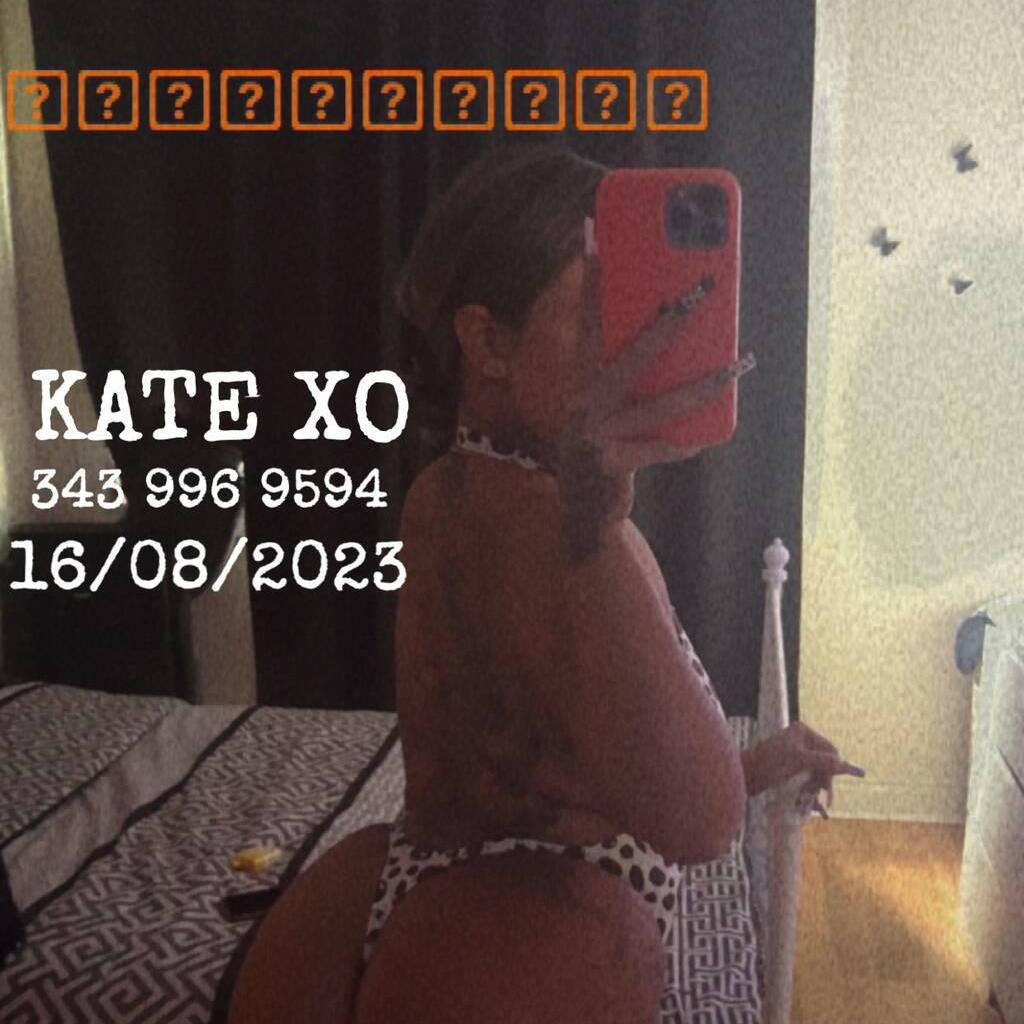 Kate Xo (Lost Contacts) is Female Escorts. | Niagara | Ontario | Canada | canadatopescorts.com 