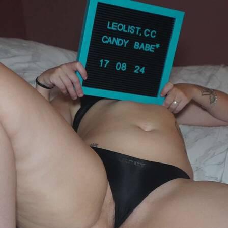 Candybabe is Female Escorts. | Ottawa | Ontario | Canada | canadatopescorts.com 