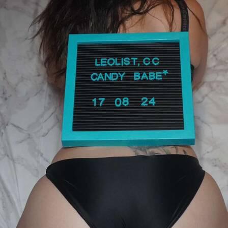 Candybabe is Female Escorts. | Ottawa | Ontario | Canada | canadatopescorts.com 